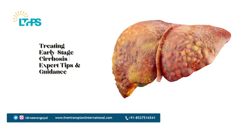 Treating Early-Stage Cirrhosis | Expert Tips & Guidance