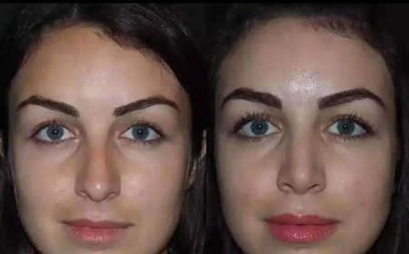 Best Rhinoplasty Surgeon in Dubai Shares Pre-Op and Post-Op Tips