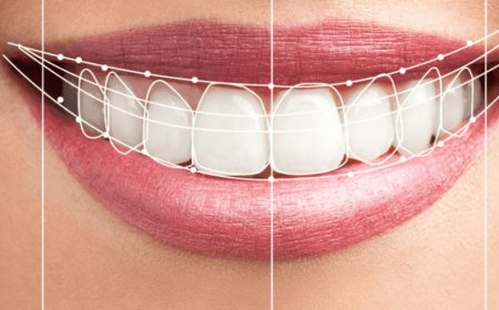 Digital Smile Design Dubai: Create Your Perfect Smile with Cutting-Edge Technology