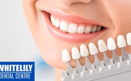 Why Regular Dental Checkups in Oakville Can Save You Thousands Later