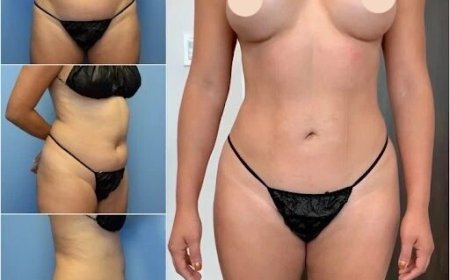 How Body Contouring in Dubai Works for Different Body Types