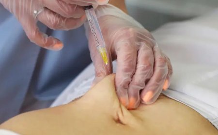 Top 5 Non-Surgical Skin Treatments at Lush Aesthetic Studio in Islington