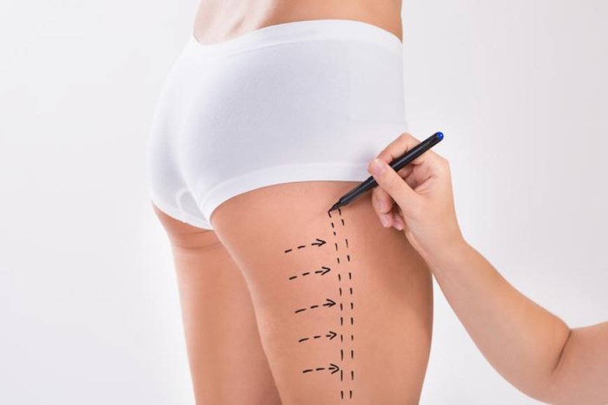 Elevate Your Look with The Best Liposuction Surgeon in Dubai