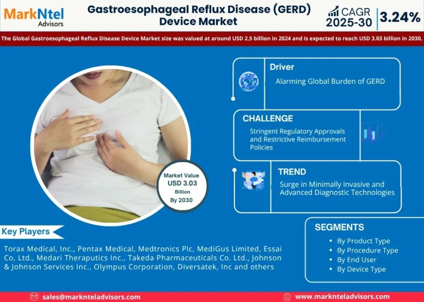 Gastroesophageal Reflux Disease (GERD) Device Forecast 2030: Growth Trends, Key Players & Future Outlook | orax Medical, Inc., Pentax Medical, Medtronics Plc, MediGus Limited, Essai Co, and others