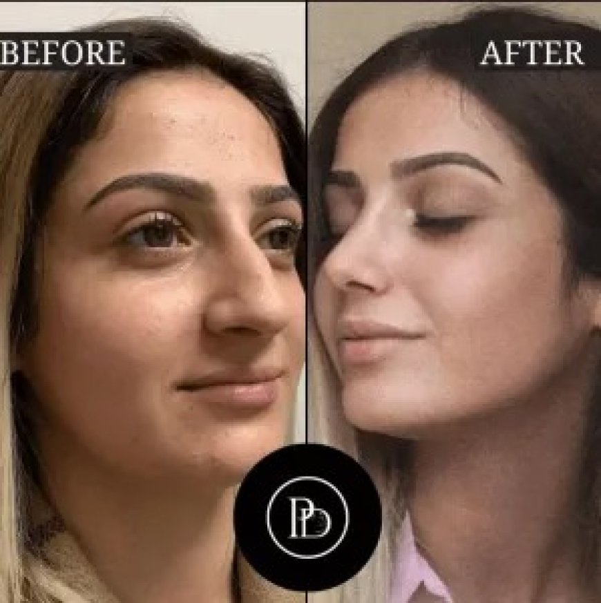 Real Stories, Real Results: PRP Treatment in Dubai