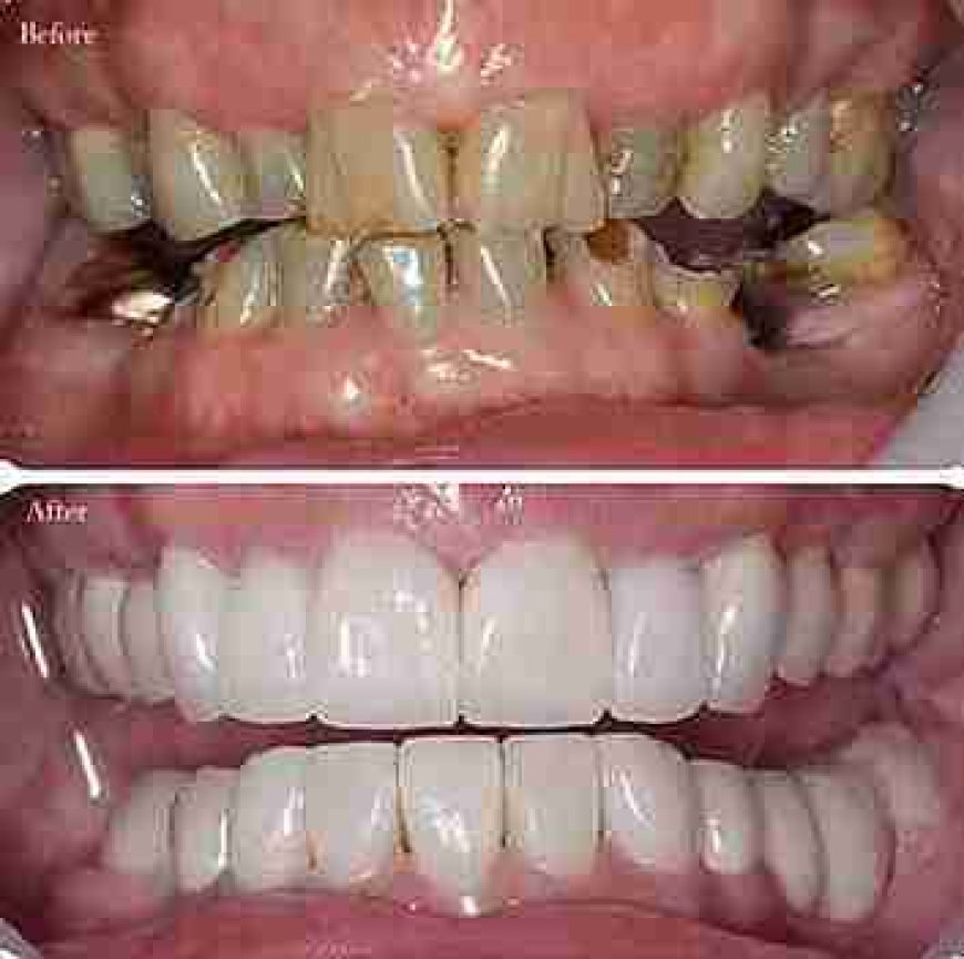 Image Source - Private Dentist Earsfield