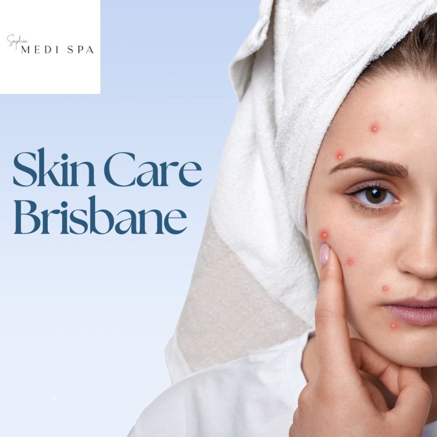 Brisbane’s Trusted Skin Treatment Experts – Reveal Healthier, Glowing Skin