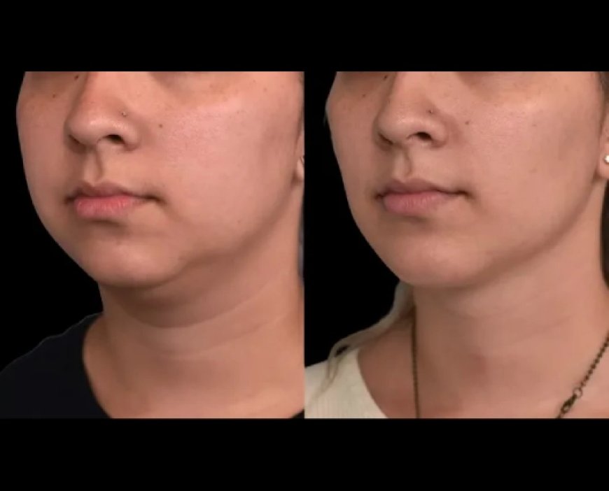 Best Doctors in Dubai Recommend Lifestyle Changes for Lasting Results