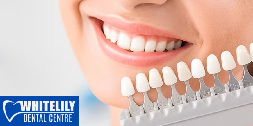 Why Regular Dental Checkups in Oakville Can Save You Thousands Later